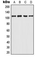 Polyclonal Rabbit anti-Human AR / Androgen Receptor Antibody (phospho-Tyr363, WB)