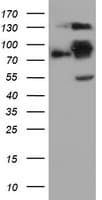 FOLH1 / PSMA Antibody (clone OTI3E8)