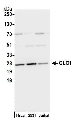 GLO1 / Glyoxalase I Antibody (aa134-184)