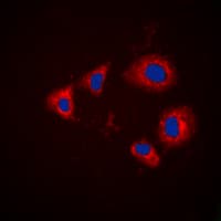Polyclonal Rabbit anti-Human AURKA / Aurora-A Antibody (phospho-Thr288, IHC, IF, WB)