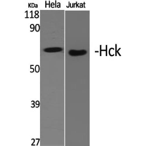 HCK Antibody (350-430 aa)