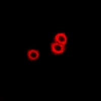 PSAT1 Antibody