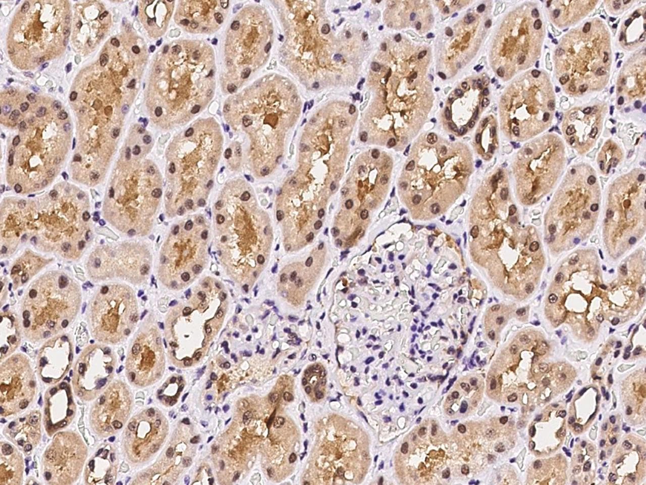 PSMA4 Antibody