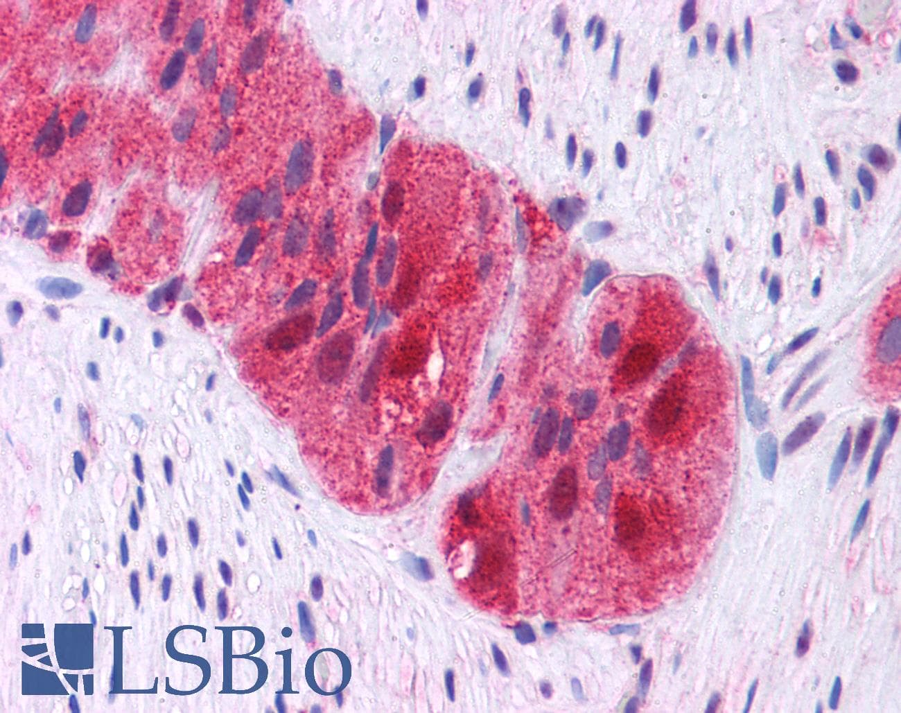 IHC-plus™ Polyclonal Rabbit anti-Human GRB2 Antibody (clone Polyclonal, C-Terminus, IHC, WB)