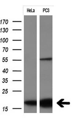 p16INK4a / CDKN2A Antibody (clone OTI7H6, Carrier-free)