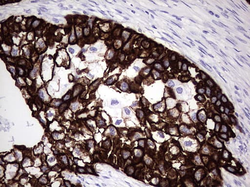 KRT7 / CK7 / Cytokeratin 7 Antibody (aa1-114, clone UMAB161, Carrier-free)
