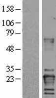 VHL / Von Hippel Lindau Protein (Over-Expression Lysate Myc-DDK (Flag))