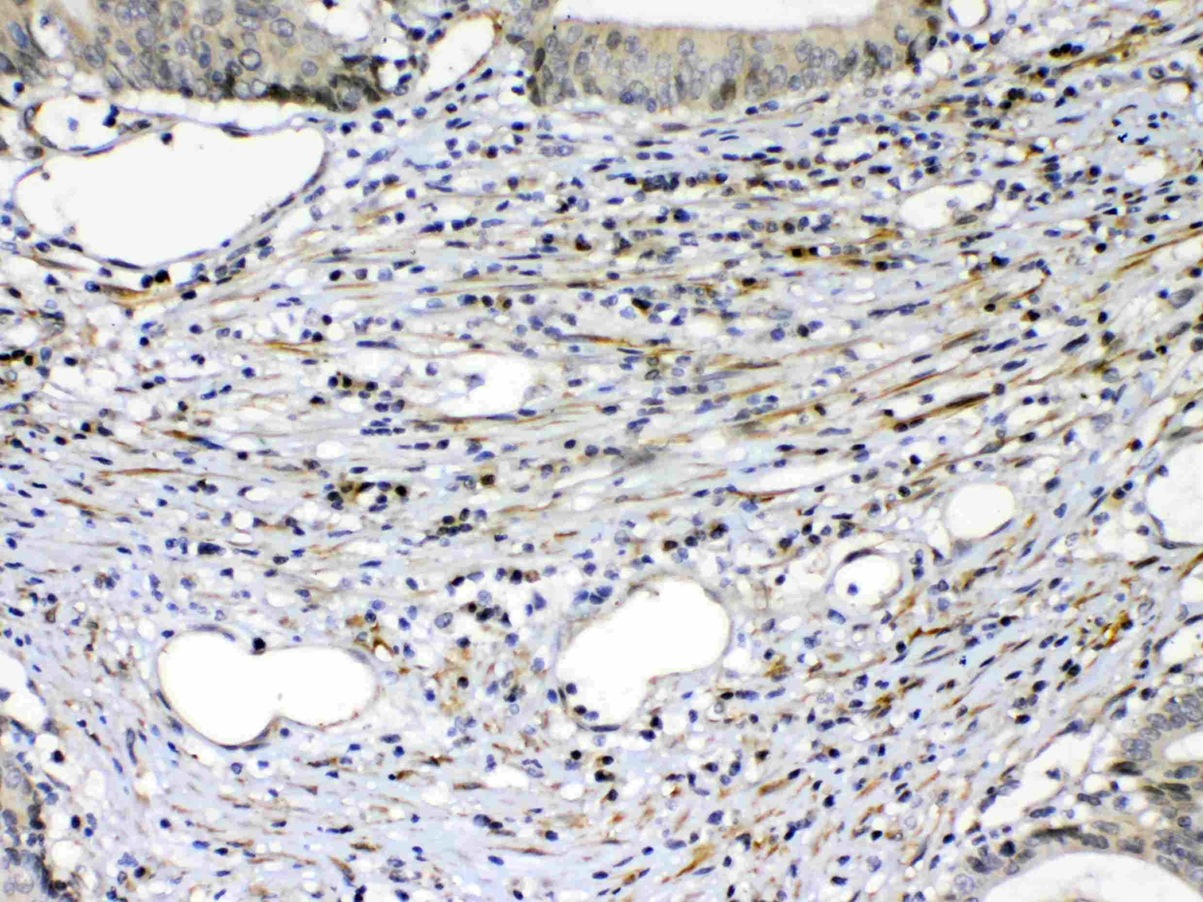KDR / VEGFR2 / FLK1 Antibody