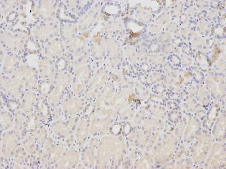 IHC-plus™ ACTN1 Antibody