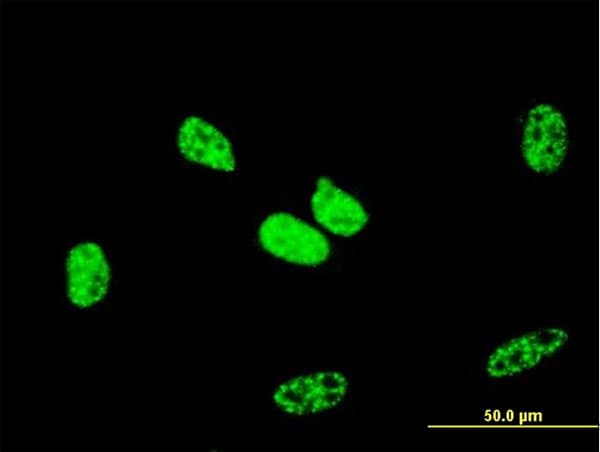 IHC-plus™ RBBP6 Antibody (clone 5A11)