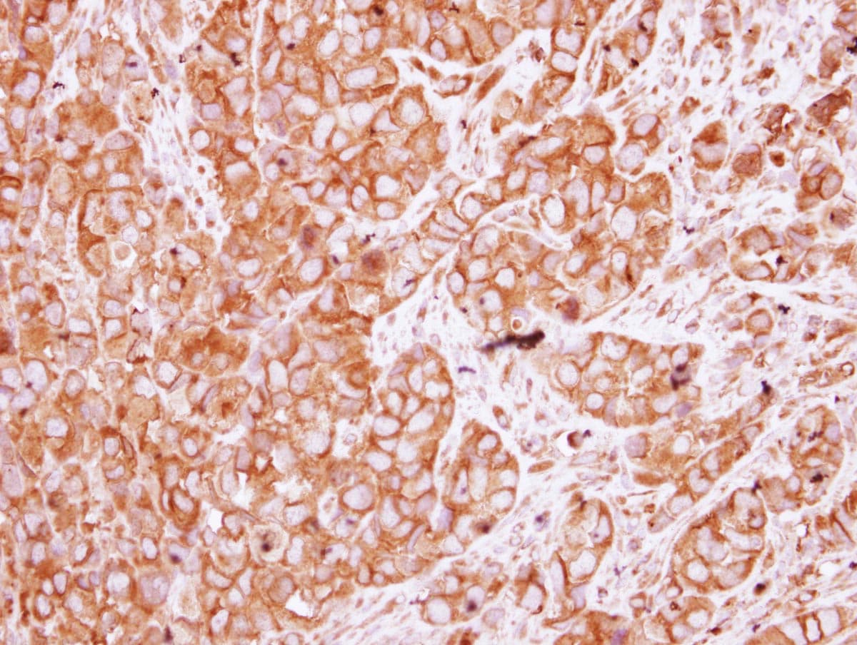 CHRNB1 Antibody