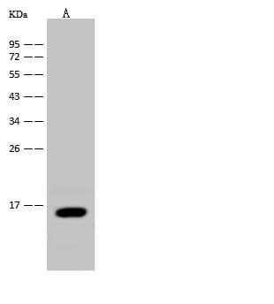 Polyclonal Rabbit anti-Mouse I-FABP / FABP2 Antibody (IF, WB)