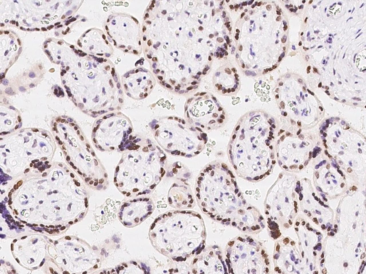 Polyclonal Rabbit anti-Human CDYL Antibody (IHC, IF, WB)