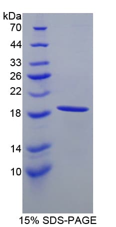 Bovine HBA1 Protein (Recombinant His-T7)