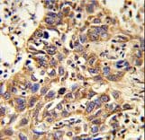 CAT / Catalase Antibody (aa152-180)