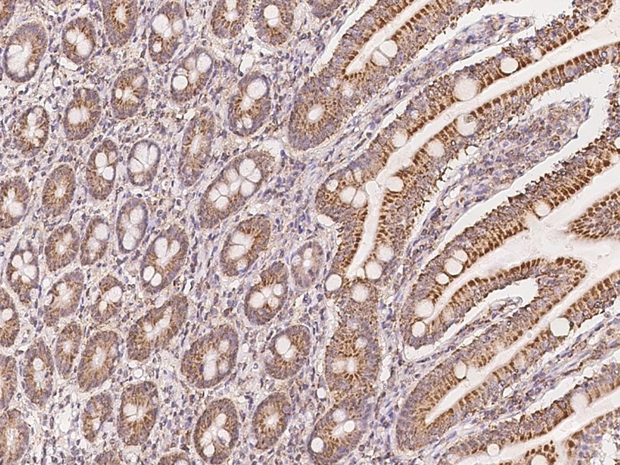 NDUFA10 Antibody