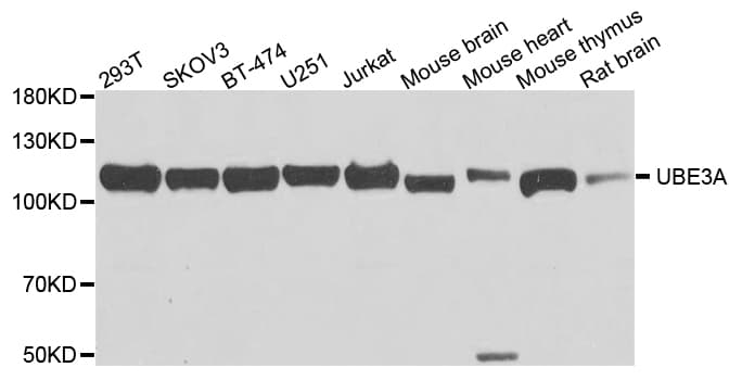 E6AP / UBE3A Antibody