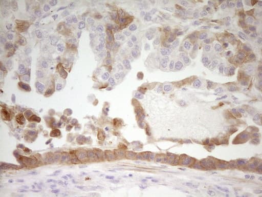 Monoclonal Mouse anti-Human APOH / Apolipoprotein H Antibody (clone OTI2C9, aa120-345, IHC, WB)