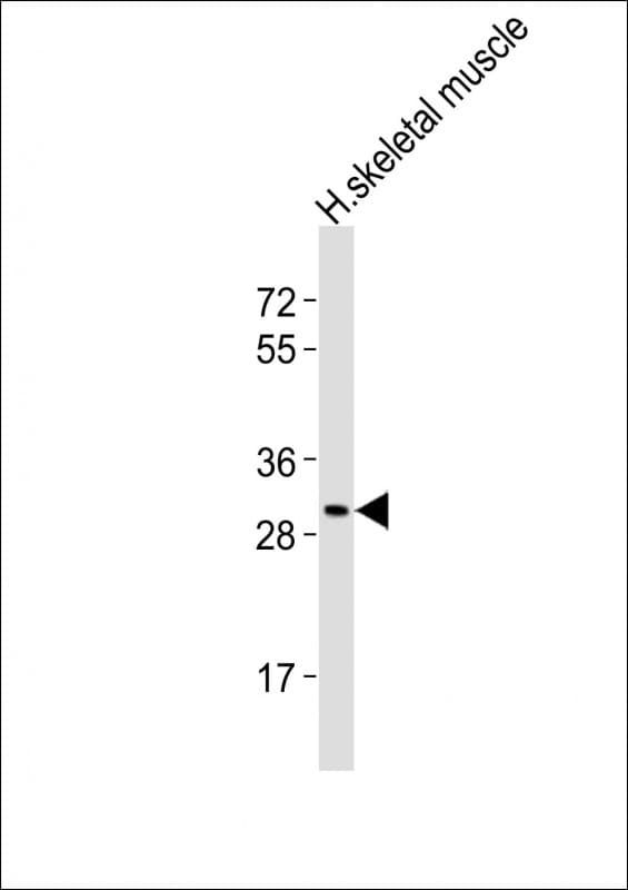 Polyclonal Rabbit anti-Human AMZ1 Antibody (aa65-96, WB)
