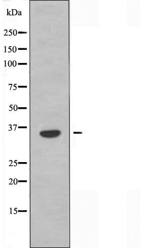 OR52B2 Antibody