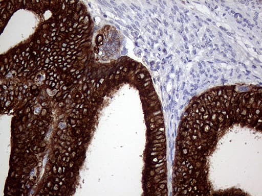 Monoclonal Mouse anti-Human AGR2 Antibody (clone OTI2B10, aa21-175, IHC, WB)