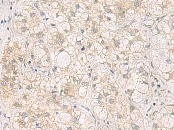 Polyclonal Rabbit anti-Human LRAT Antibody (IHC)