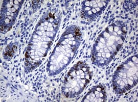 Monoclonal Mouse anti-Human MKI67 / Ki67 Antibody (clone OTI5D7, IHC)