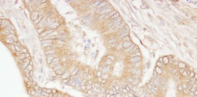 Polyclonal Rabbit anti-Human USP5 Antibody (aa375-425, IHC)
