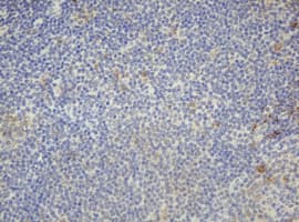 F13A1 / Factor XIIIa Antibody (clone OTI3F8)