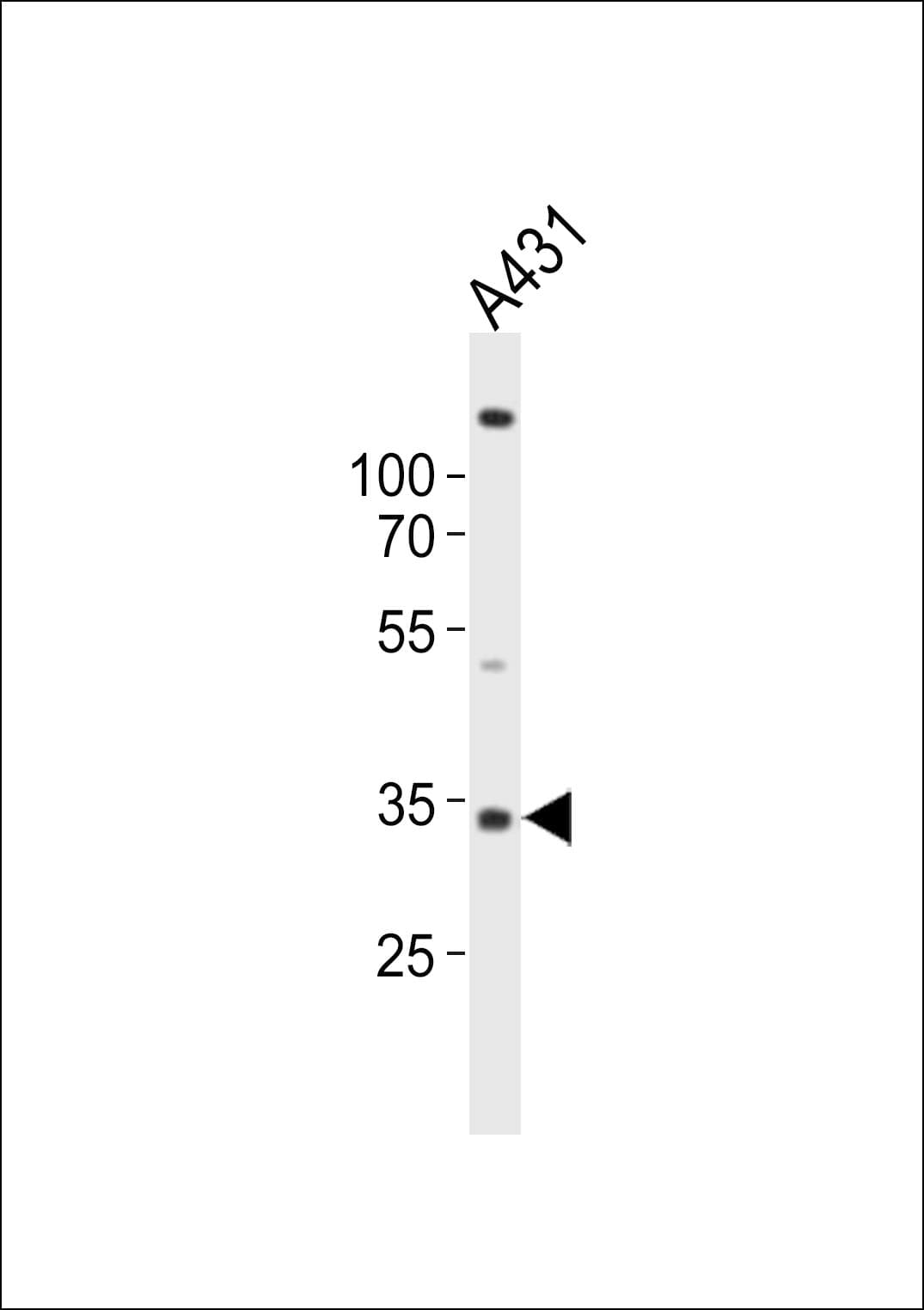 IHC-plus™ UTF1 Antibody (aa164-199)