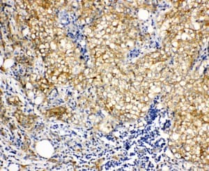 Polyclonal Rabbit anti-Human VCL / Vinculin Antibody (aa173-188, IHC, WB)