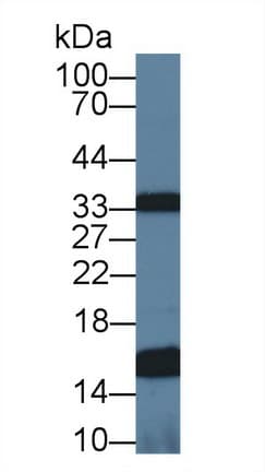 UQCRB Antibody (aa2-111)