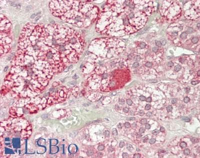 IHC-plus™ BIRC2 / cIAP1 Antibody (aa216-244)