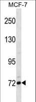 FCRL5 / CD307 Antibody (aa302-331)