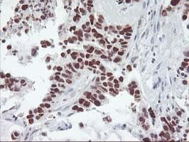 TP53 / p53 Antibody (clone OTI2H6, Carrier-free)