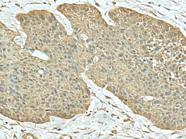 FN3KL / FN3KRP Antibody