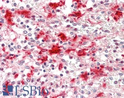 IHC-plus™ LIPA / Lysosomal Acid Lipase Antibody (clone GF1)
