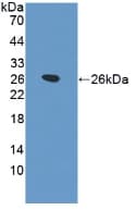 SFTPB / Surfactant Protein B Antibody (aa111-352, APC)