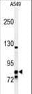 NR3C1/Glucocorticoid Receptor Antibody (aa713-742)