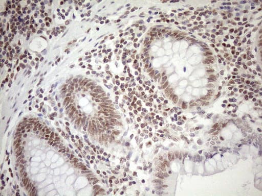 MGMT Antibody (clone OTI6C4)