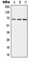 ALPI / Alkaline Phosphatase Antibody (Internal)