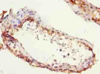 Polyclonal Rabbit anti-Human ZCCHC13 Antibody (IHC)