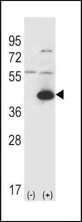 Aspartate Aminotransferase Antibody (aa352-381)
