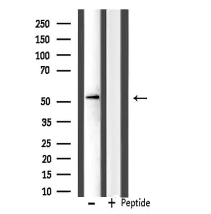 Polyclonal Rabbit anti-Human IP6K3 Antibody (IHC, IF, WB)