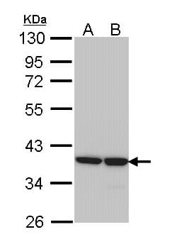 Polyclonal Rabbit anti-Human AKR1B1 / Aldose Reductase Antibody (WB)
