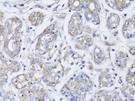 Polyclonal Rabbit anti-Human BRCA1 Antibody (IHC, IF, WB)