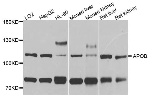 APOB / Apolipoprotein B Antibody