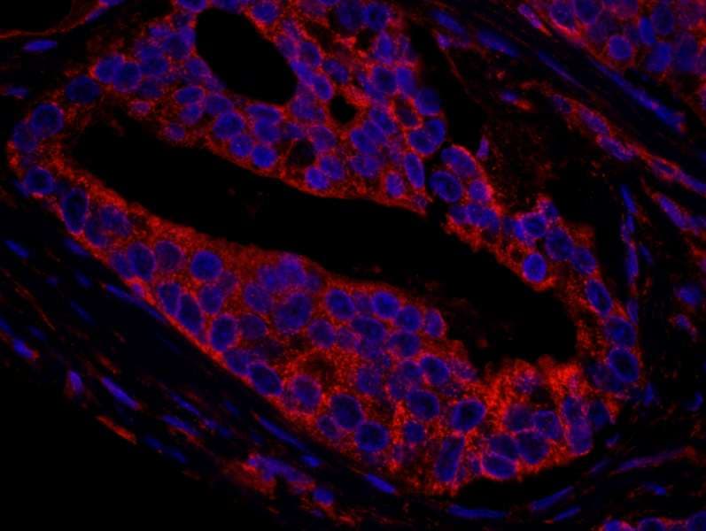 IHC-plus™ CNOT3 Antibody (aa525-575)
