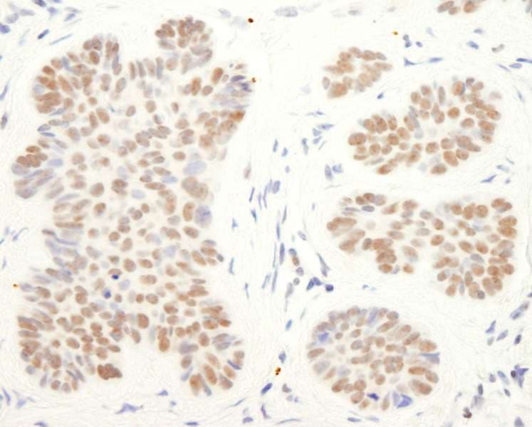 Polyclonal Rabbit anti-Human RCOR1 / COREST Antibody (aa425-C-term, IHC, WB)