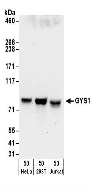 Polyclonal Rabbit anti-Human GYS1 / Glycogen Synthase Antibody (aa687-737, WB)